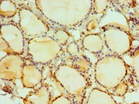 DIDO1 Antibody