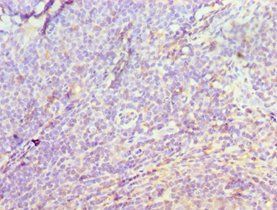 DIDO1 Antibody