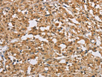 DIDO1 Antibody