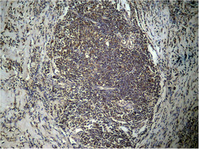 Di-Methyl-Histone H3 (Lys27) Antibody
