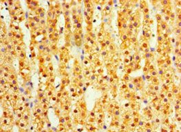 DIMT1 Antibody