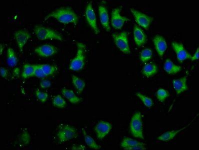 DIO2 Antibody