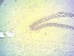 DIO2 Antibody