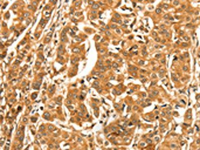 DIRAS1 Antibody