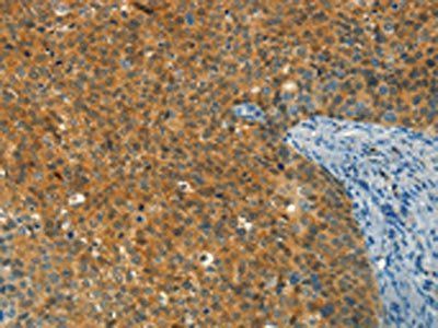 DIRAS1 Antibody