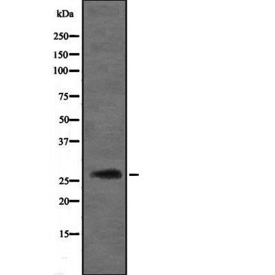 DIRAS3 antibody