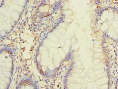 DIS3L Antibody