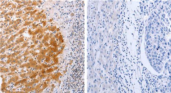 DISC1 Antibody