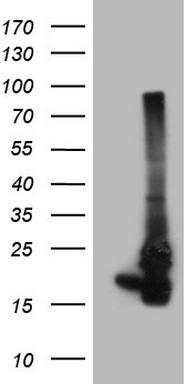 Dishevelled 2 Antibody