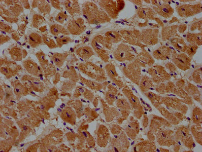DIXDC1 Antibody