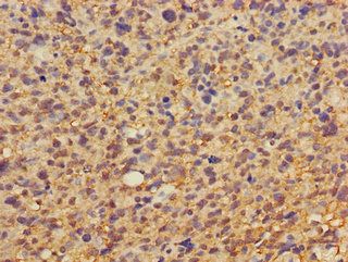 DKK1 Antibody