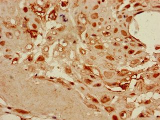 DKK1 Antibody