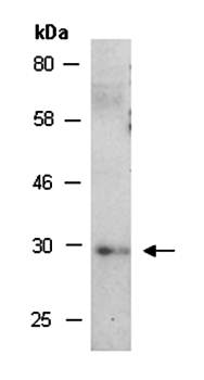 DKK1 (N) Antibody, Rabbit Polyclonal