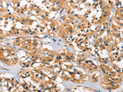 DKK3 Antibody