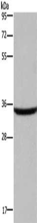 DKK3 antibody