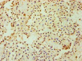 DKK4 Antibody