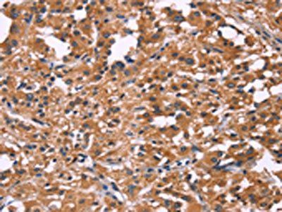 DKK4 Antibody