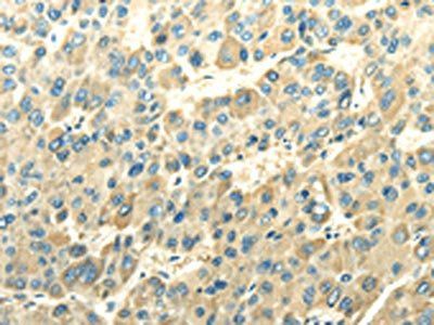 DLAT Antibody