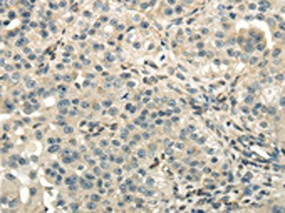 DLAT Antibody