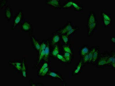 DLG1 Antibody