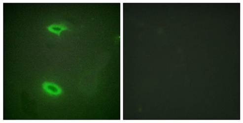 DLGP1 Antibody
