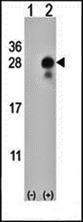 DLK2 antibody