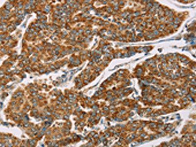 DLL4 Antibody