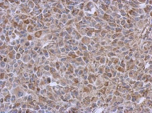 DLST antibody [N3C3]