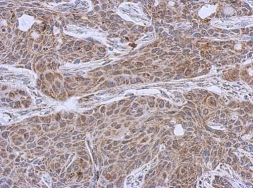 DLST antibody [N3C3]