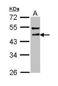 DLST antibody [N3C3]