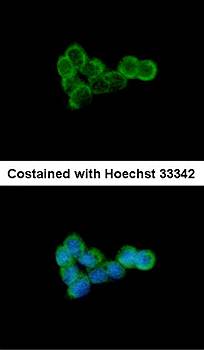 DLST antibody