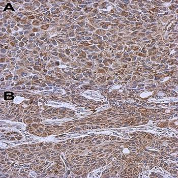 DLST antibody