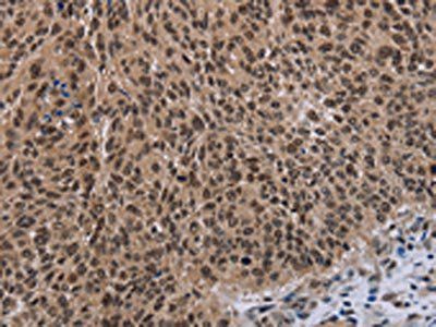 DLX4 Antibody