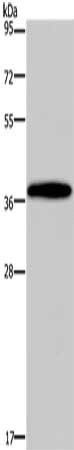 DLX4 Antibody