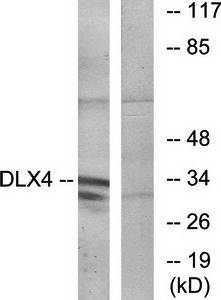 DLX4 Antibody