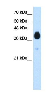 DLX5 antibody