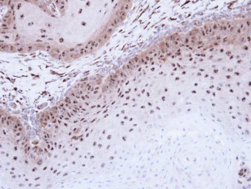 DMC1 antibody [N1C1]