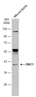 DMC1 antibody