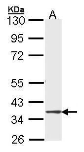 DMC1 antibody