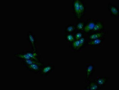 DMC1 antibody