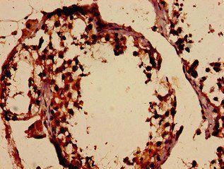 DMC1 Antibody