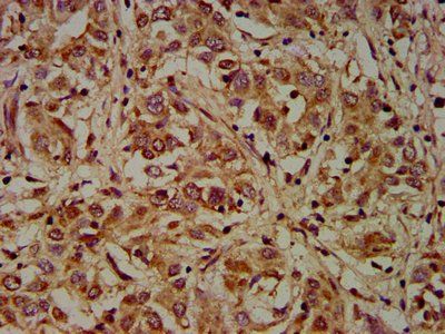 DMD Antibody