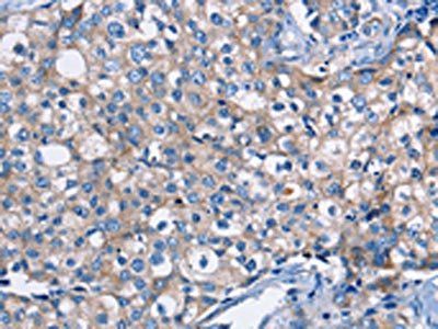 DMD Antibody