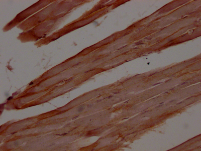 DMD Recombinant Monoclonal Antibody
