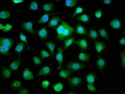 DMPK Antibody
