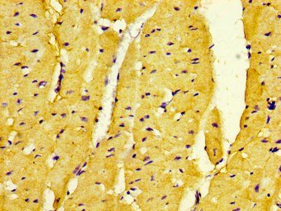 DMPK Antibody