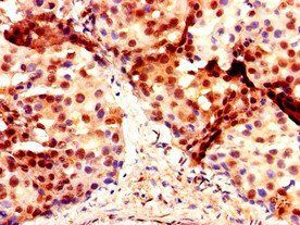 DMRT1 Antibody