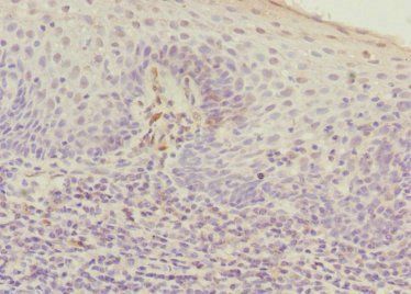 APEX1 Antibody