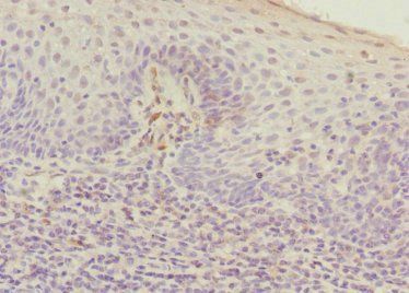 DNA-(apurinic or apyrimidinic site) lyase antibody