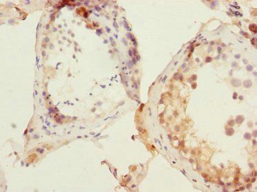 DNA-(apurinic or apyrimidinic site) lyase antibody